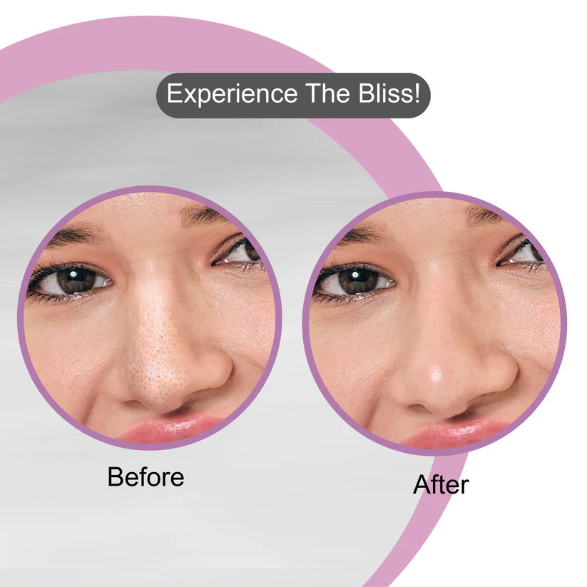 DR.RASHEL CHARCOAL NOSE STRIPES