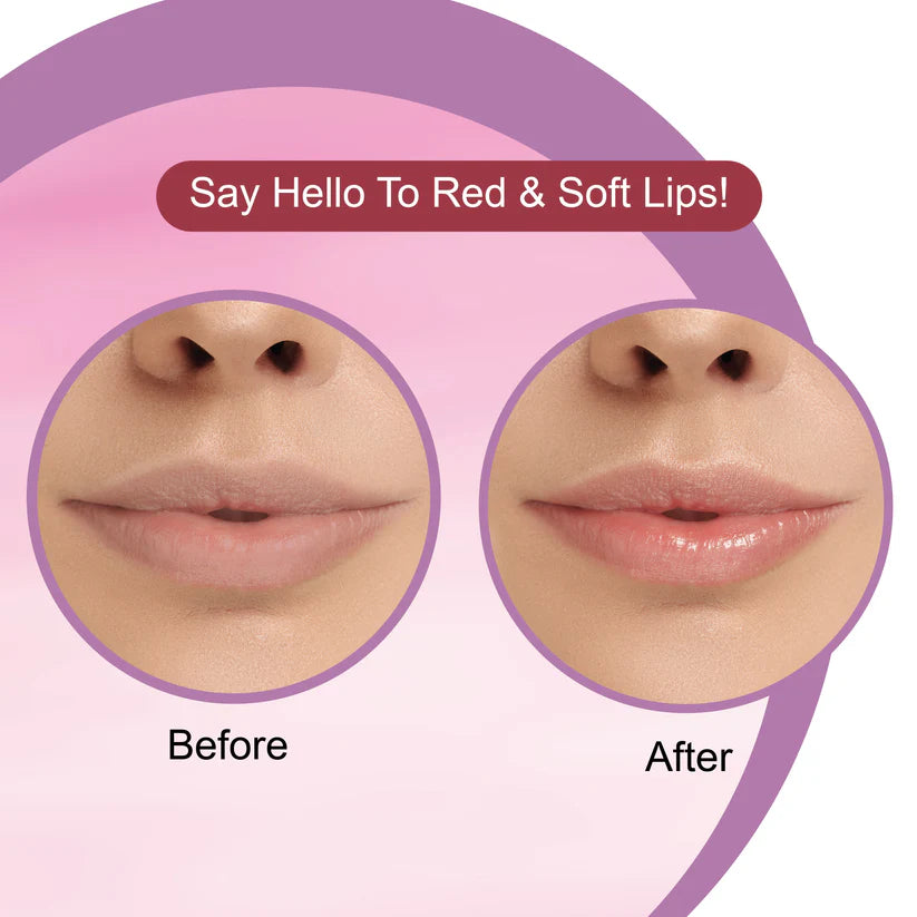 DR.RASHEL  CHERRY LIP BLAM