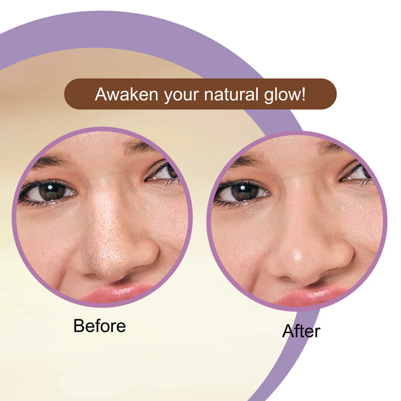 DR.RASHEL COFFEE NOSE STRIPES