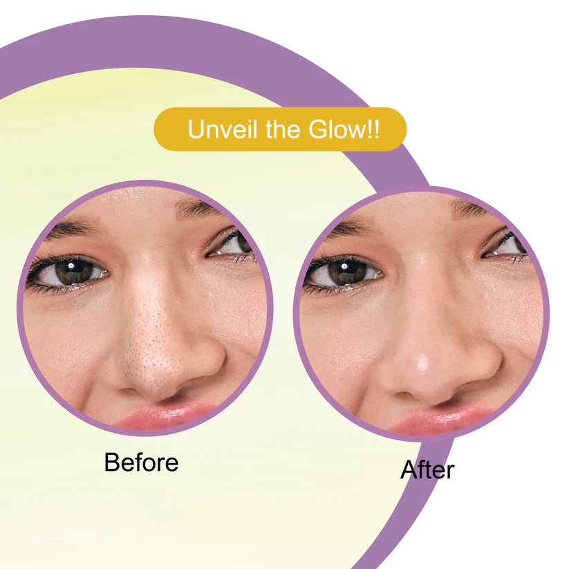 DR.RASHEL DE-TAN NOSE STRIPES