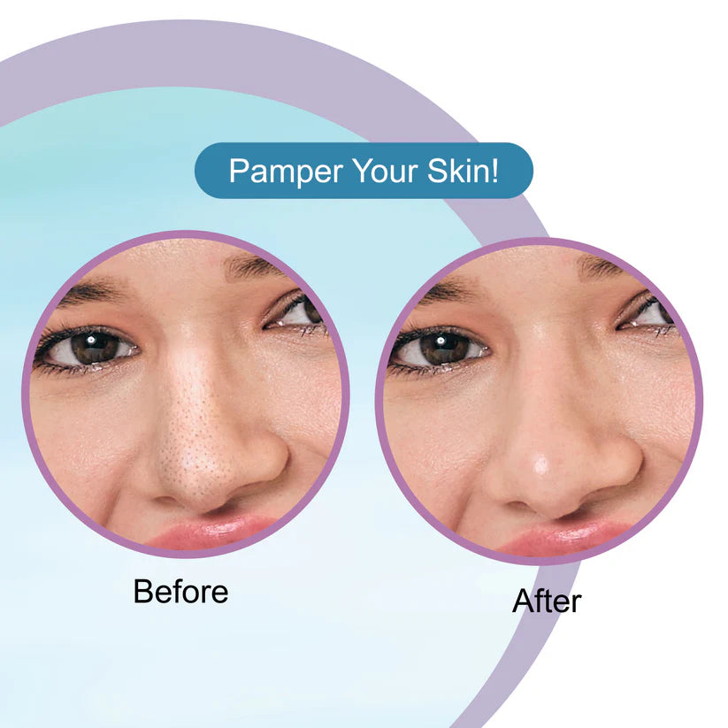 DR.RASHEL HYALURONIC ACID NOSE STRIPES