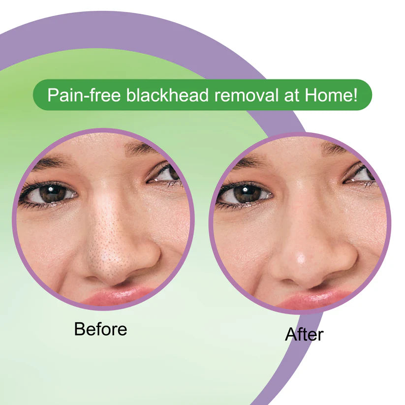 DR.RASHEL TEA TREE NOSE STRIES