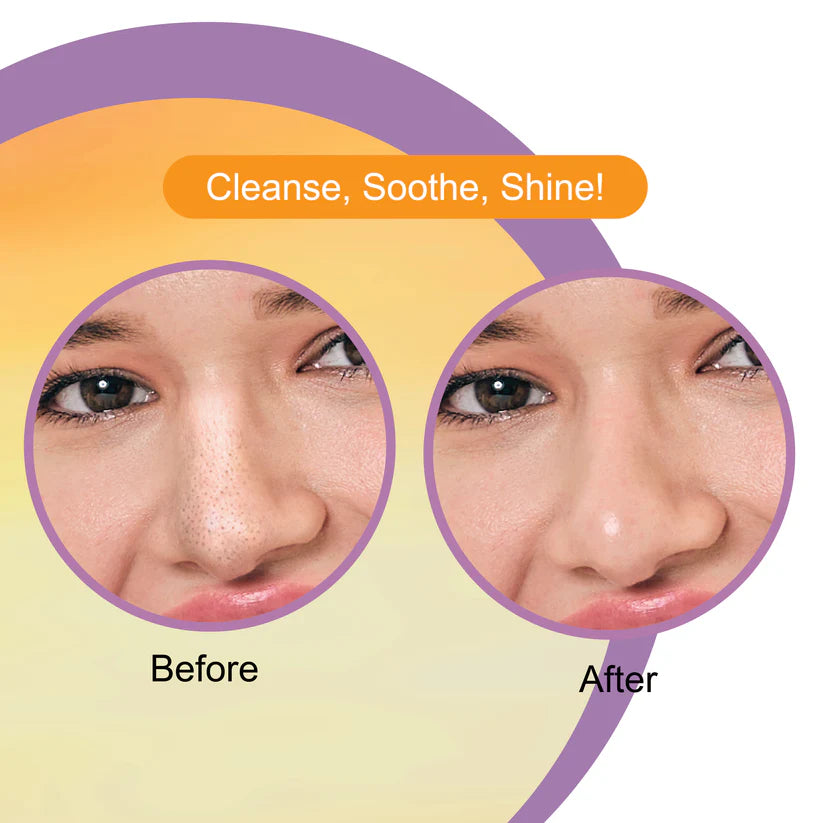 DR.RASHEL VITAMIN C NOSE STRIPES