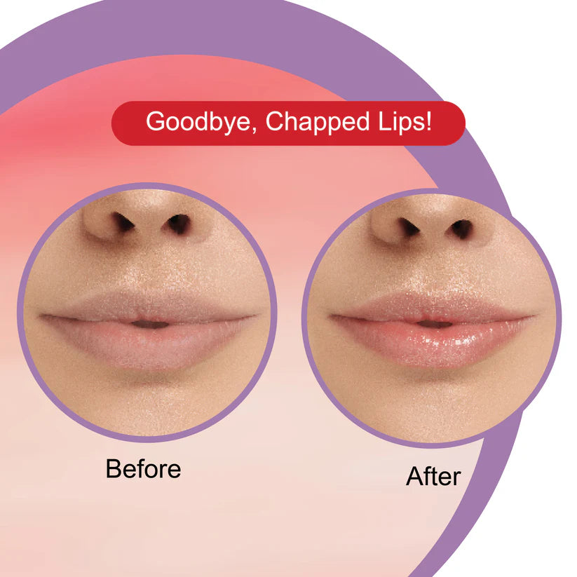 DR.RASHEL WATERMELON LIP BLAM