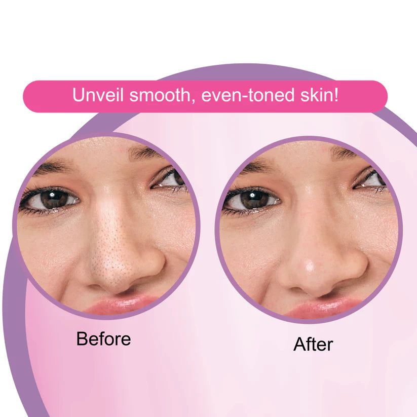 DR.RASHEL WHITE SKIN NOSE STRIPES